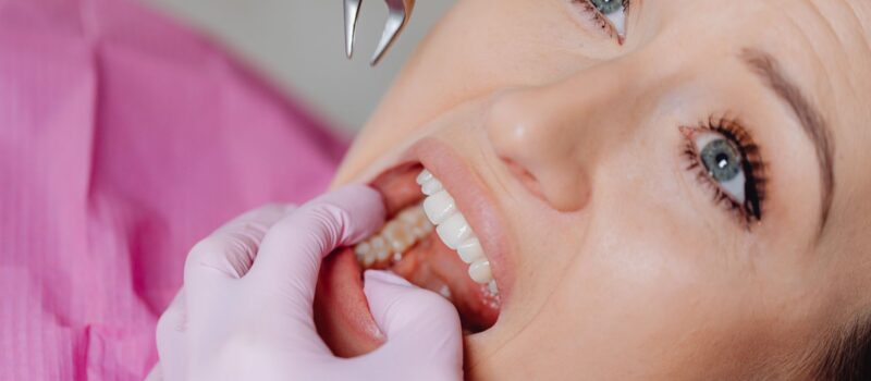 tooth extractions