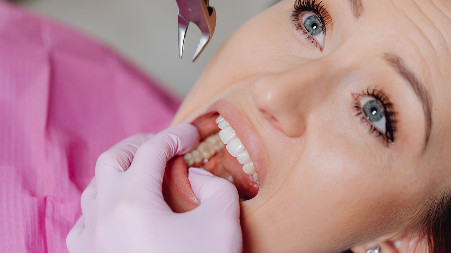 tooth extractions