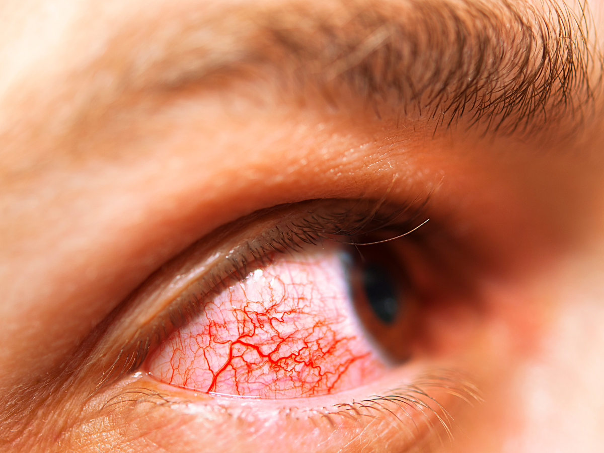 Eye exams Ajax