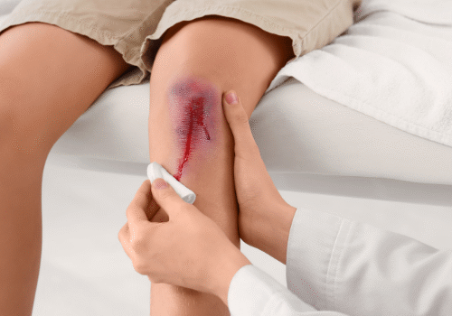 minor injuries care Welland services